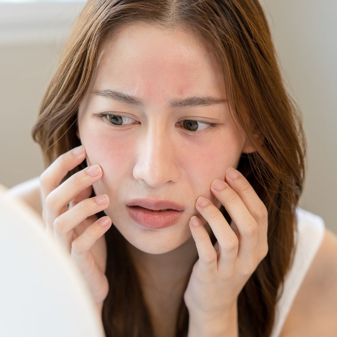 Dry Skin Care: Easy Tips for Soft and Healthy Skin